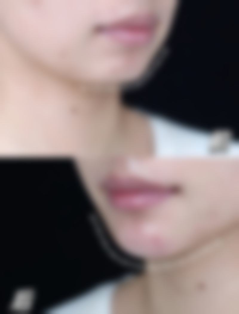 【佛山禅城屋户整形医院医生团队情况：】