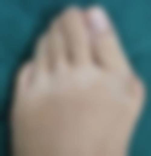 美白针与美白面膜的对比