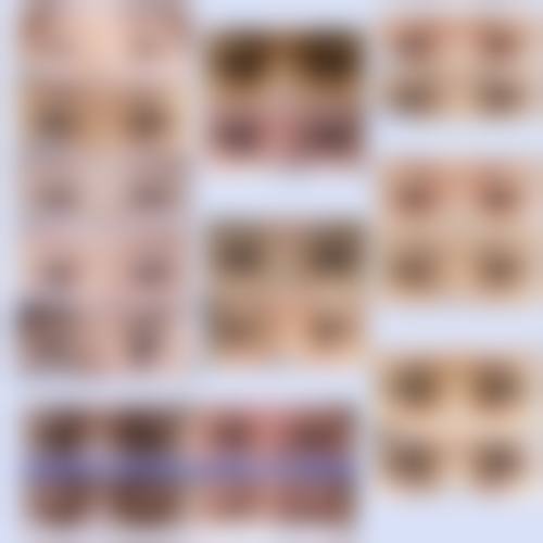 【张大力医生技术特点】