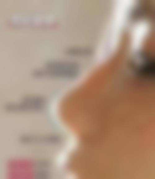 【郑州延丽整形医院地址：】