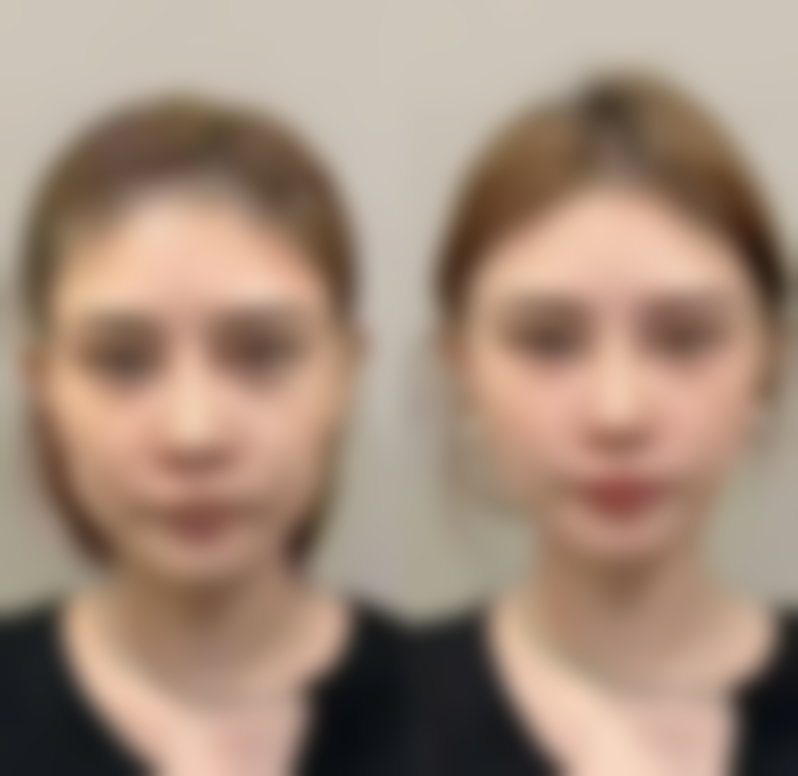 【台州悠兰医疗美容诊所患者口碑评价：】