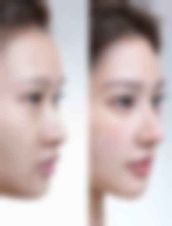 【张大力医生擅长项目】