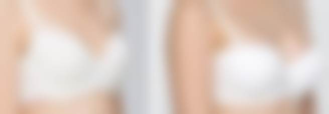 重庆联合丽格第五医美脱毛年卡项目的技术优势