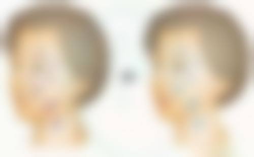 喷雾抗衰祛皱有什么危害