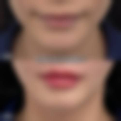 该医院开展了众多特色整形美容项目，涵盖了眼部整形、鼻部整形、面部轮廓、胸部整形、美体塑形、皮肤美容、抗衰抗初老、私密整形、自体脂肪等。并且结合了欧洲高超的整形外科技术和流行的国内台湾微整形外科技术，为顾客提供多样化的选择。