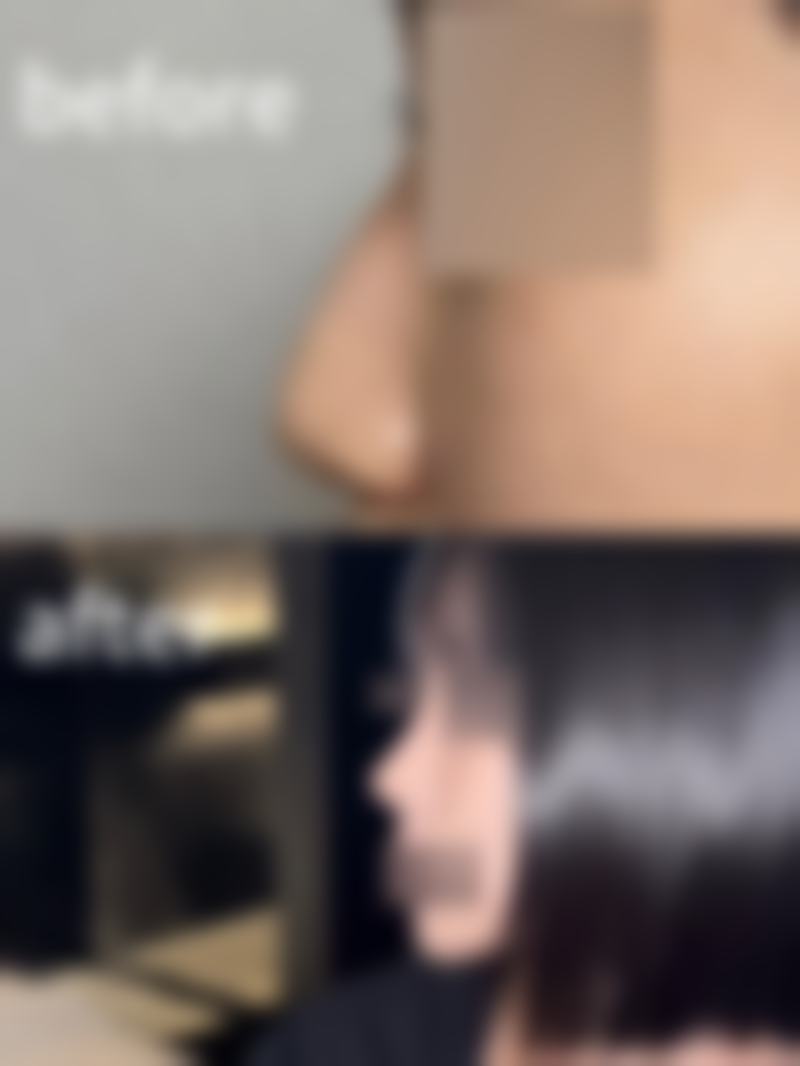 【郑州美诗沁医疗美容诊所是正规的吗?】