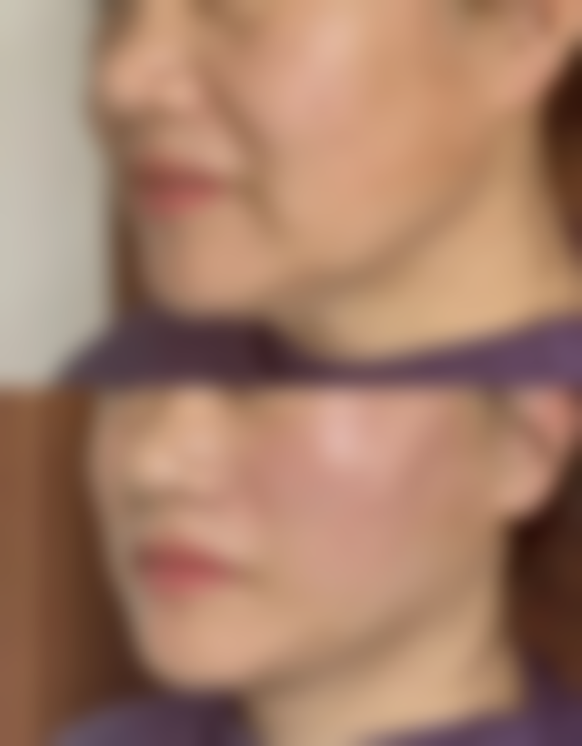 【西安琅丽医疗美容特色项目：】