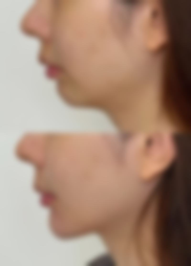 种植的毛发能生长吗？