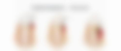 下颚骨方怎么矫正？3种主流医美方案大揭秘，让你轻松拥有精致小V脸！ 