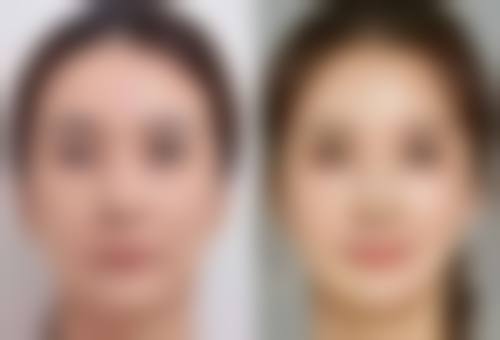 下颚骨方怎么办