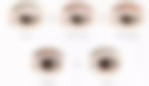 丰太阳穴需要多少支玻尿酸