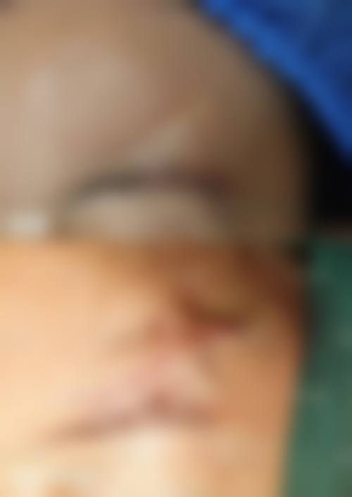 【景洪普惠医院整形美容中 心怎么预约挂号?】