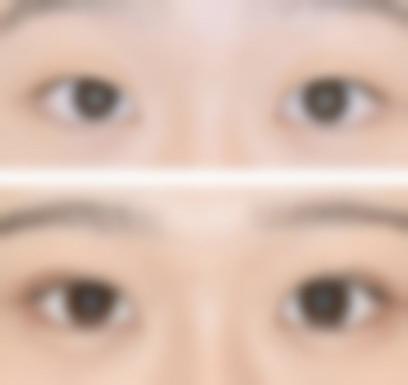 【吴冬梅医生口碑怎么样？】