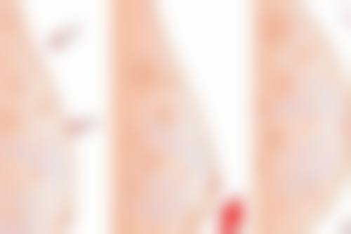 【上海朱秀兰医疗美容诊所是正规的吗?】