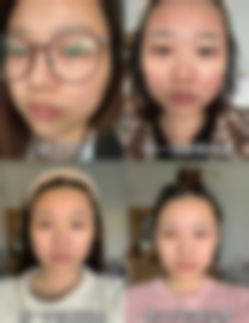 阴道紧缩术术后成效