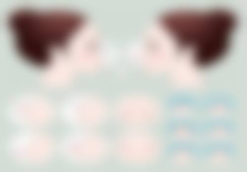 自体脂肪填充能维持多久