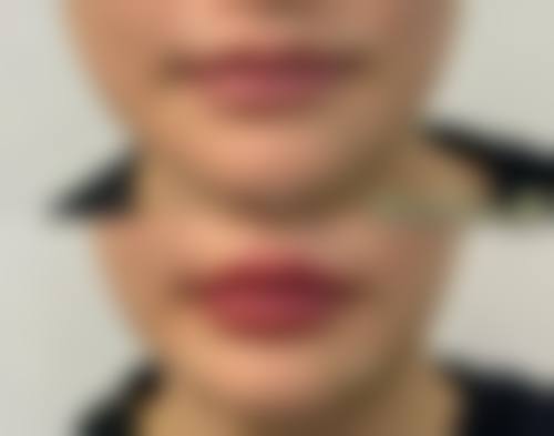 【温州摩根艺术整形医疗美容医院是正规的吗?】