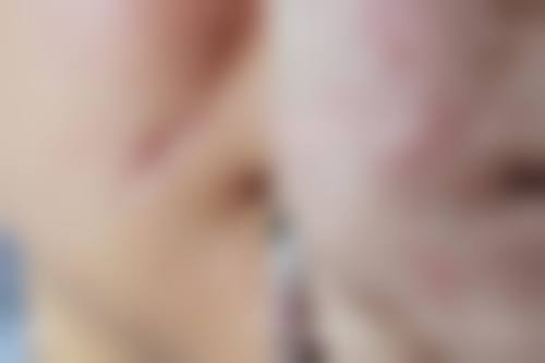 【赣州亚韩整形美容门诊部是正规的吗?】