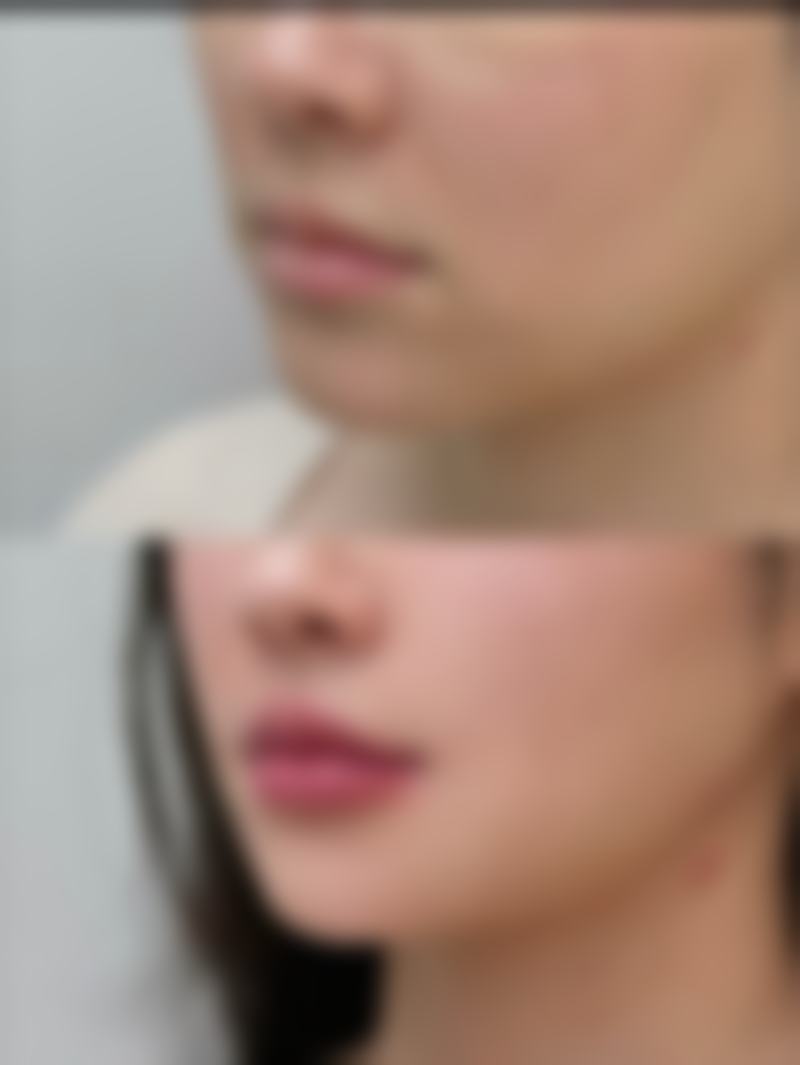 头发怎么种植毛囊？掌握这5大关键步骤与注意事项，让你轻松拥有浓密秀发！ 