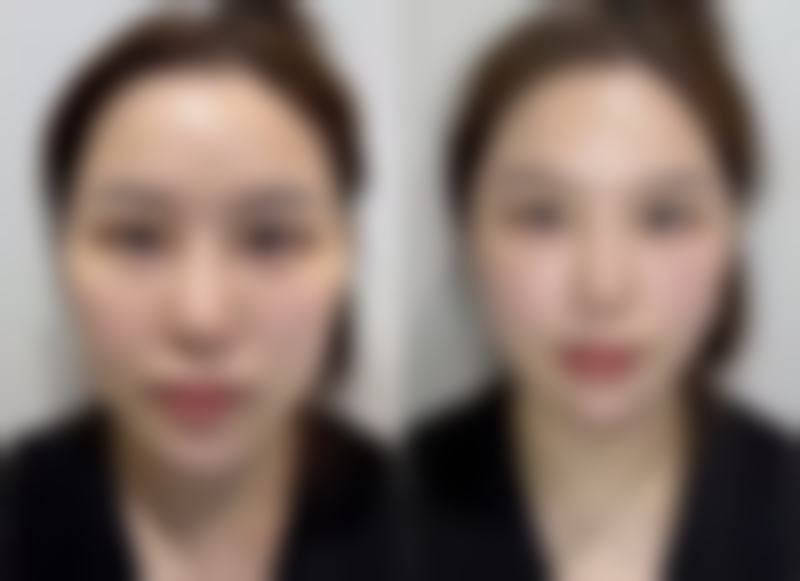 【宜春甜橙国内外整形医院参考价格表：】