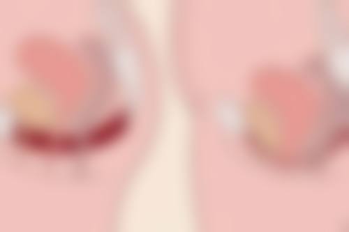 瘦脸针什么时候成效更明显