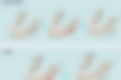 打一次瘦脸针有没有副作用