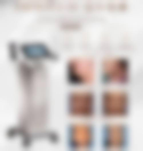 M唇整形手术过程