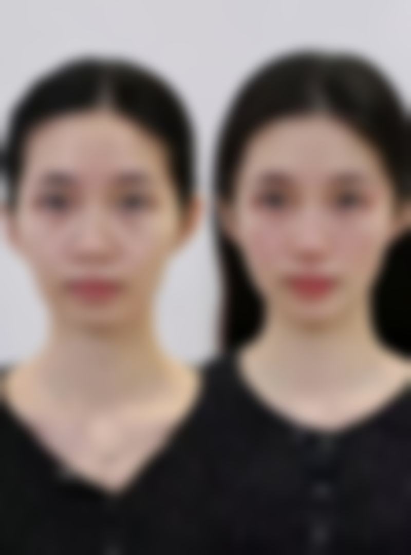 【丽江科美医疗美容诊所特色项目：】