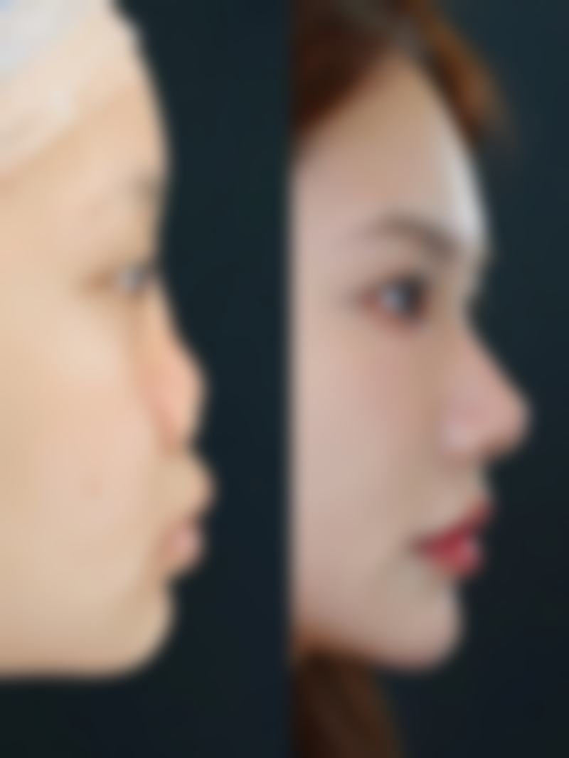 【彭州熹亚水样女人整形医院特色项目：】