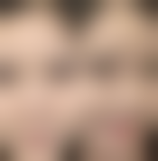 【丁埰弘医生口碑】