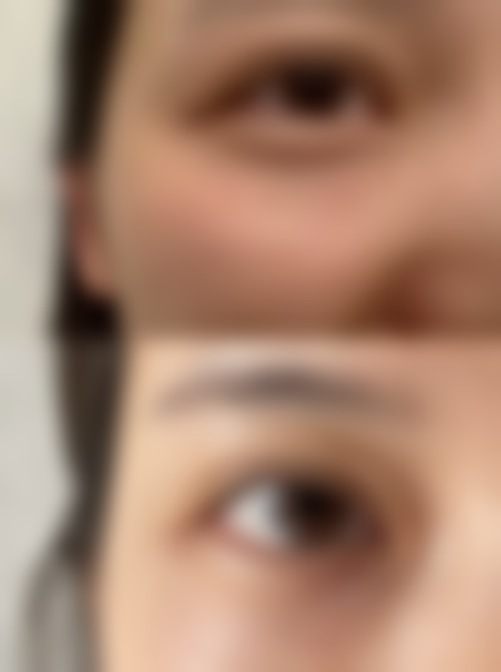 m唇整形是永久的吗？揭秘3大关键因素，让你清晰了解m唇整形持久度与效果保障！ 