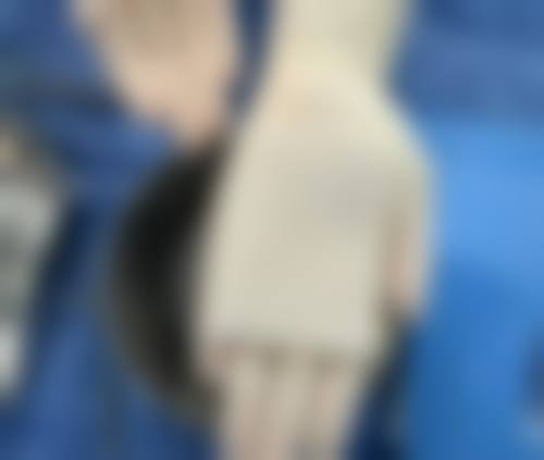 阴道紧缩术的弊端