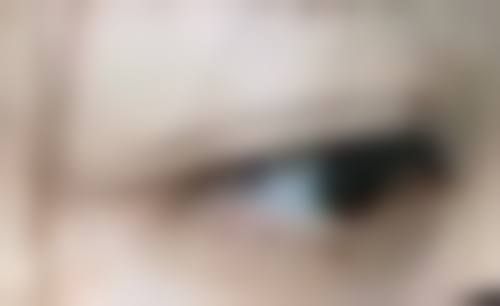 阴道紧缩术有危险吗