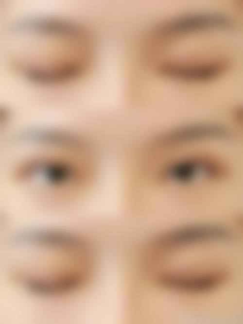 【孙佩妤医生技术特点】