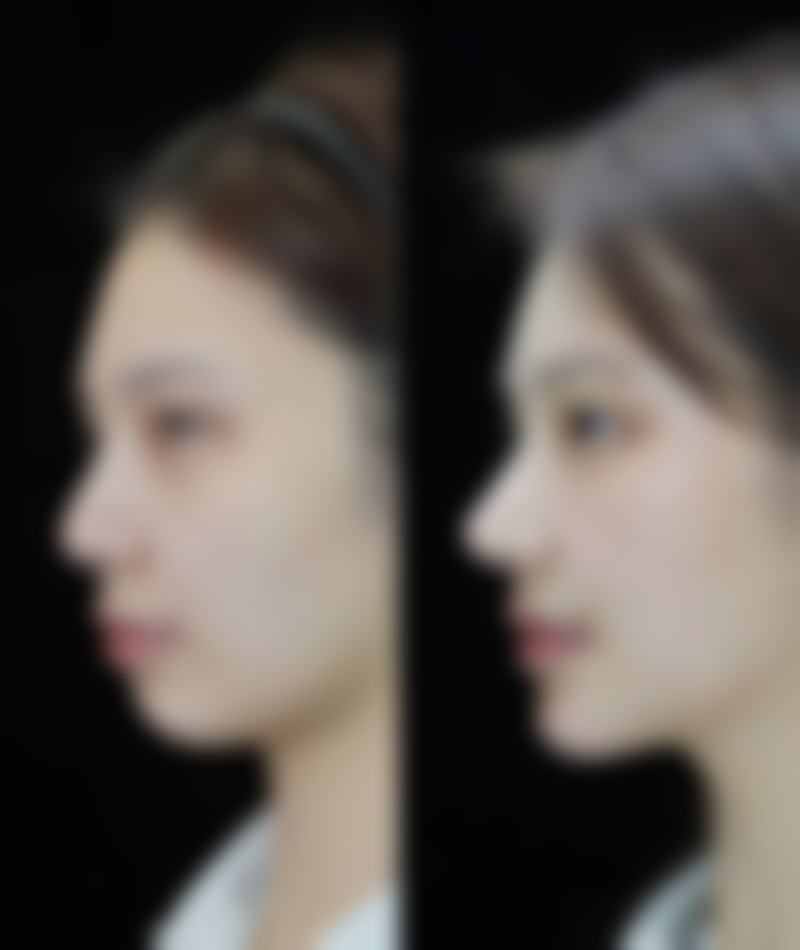 杭州香格里拉整形外科门诊部是正规的吗?