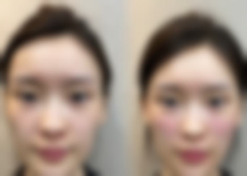 【日照市中医医院整形美容与皮肤病科诊疗设备：】