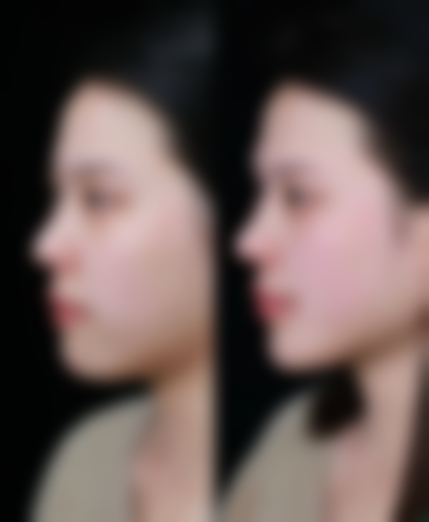 【聊城青悦整形医院参考价格表：】