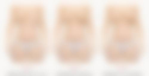 如何降低玻尿酸丰太阳穴的风险