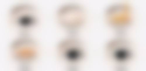 玻尿酸丰太阳穴的价格和适用人群