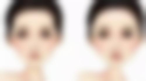 除皱针打完多久有成效