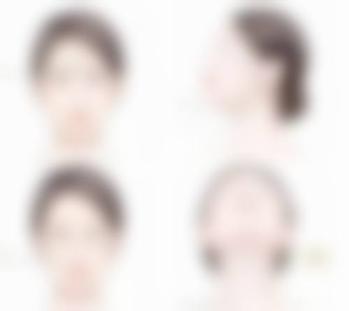 打完瘦脸针咬肌会变大吗