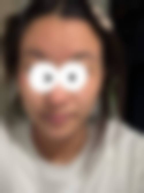 【张智医生口碑怎么样？】