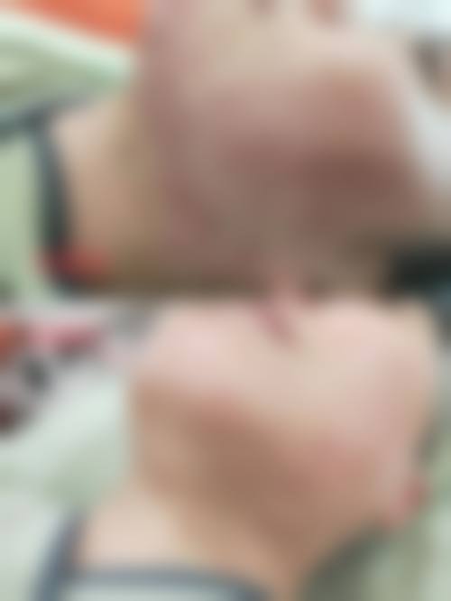 【张智医生怎么预约挂号？】