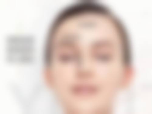 瘦脸针打一次维持多久