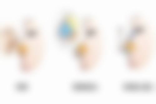 除皱针的价格及优势