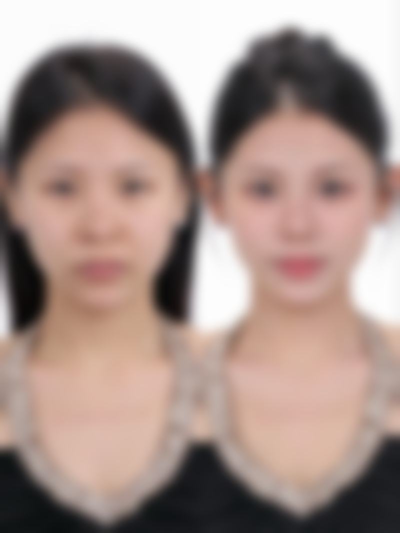 【揭阳榕江医院医疗美容科患者口碑评价：】