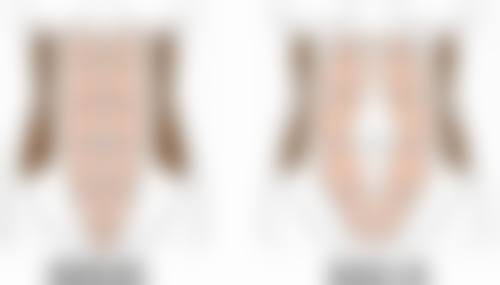 丰太阳穴材料选择的注意事项