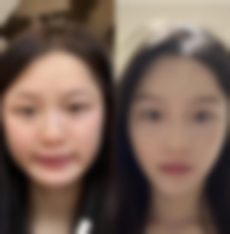 头皮有疤痕可以植发吗