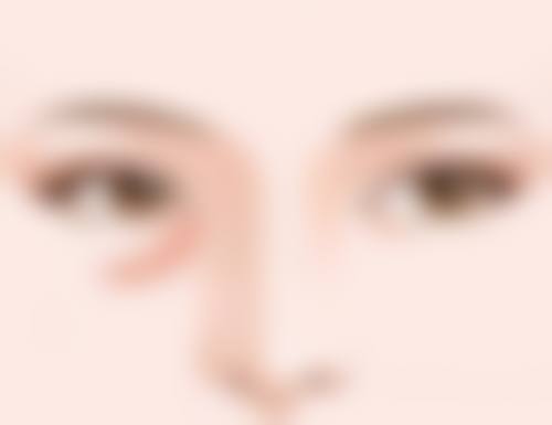 打完瘦脸针多久可以平躺