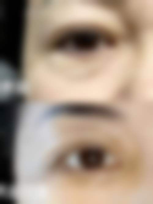 【郭炎医生怎么预约挂号？】